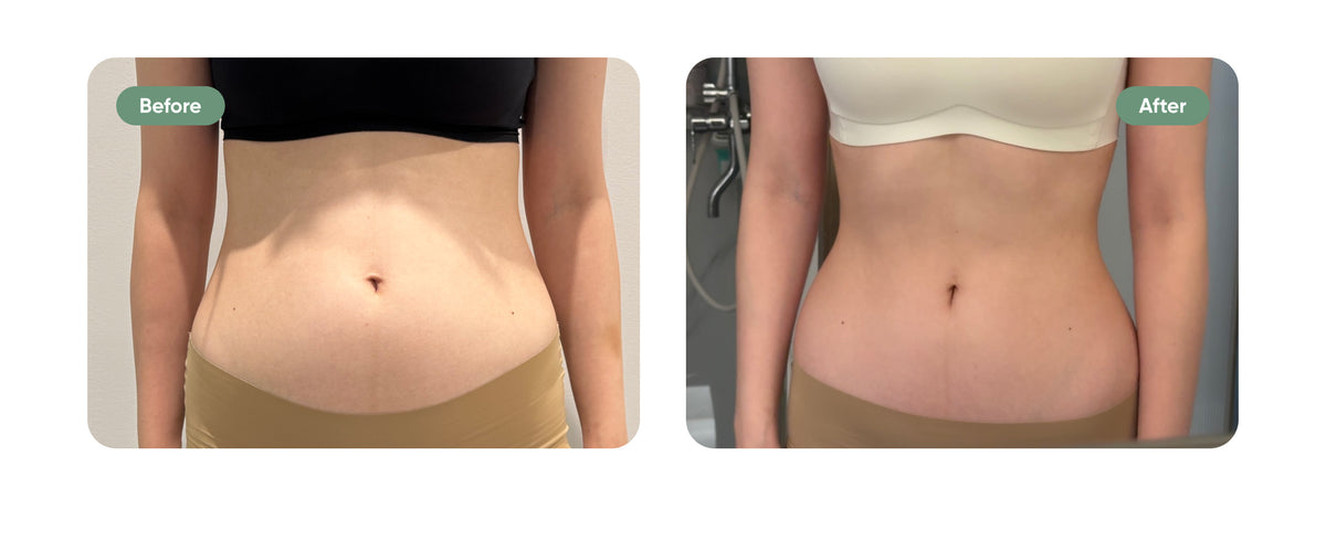 Body Sculpting