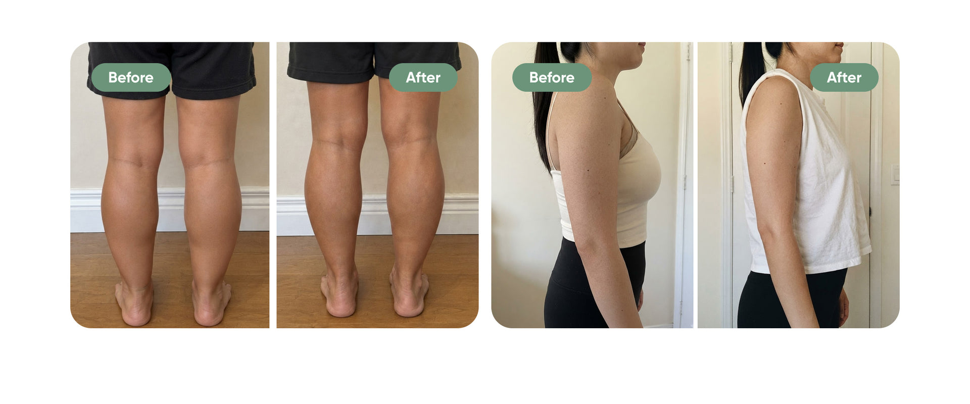 Cellulite Care