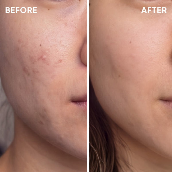 Clearer-Looking Skin