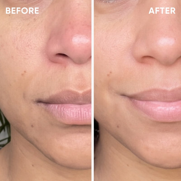 Even Texture & Glowing Skin