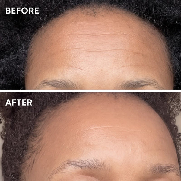 Wrinkle Smoothing