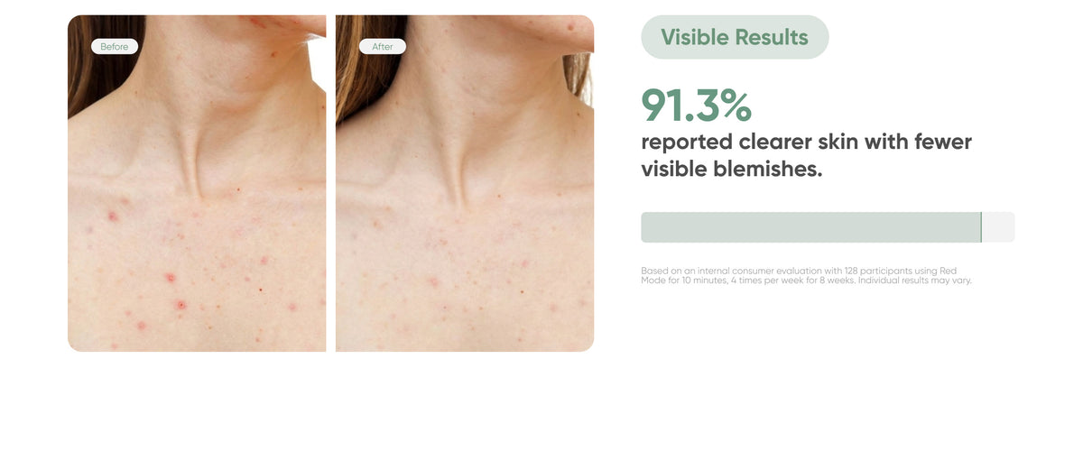Blemishes